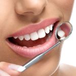 ציפויי חרסינה – שדרוג החיוך שלך