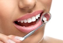 ציפויי חרסינה – שדרוג החיוך שלך